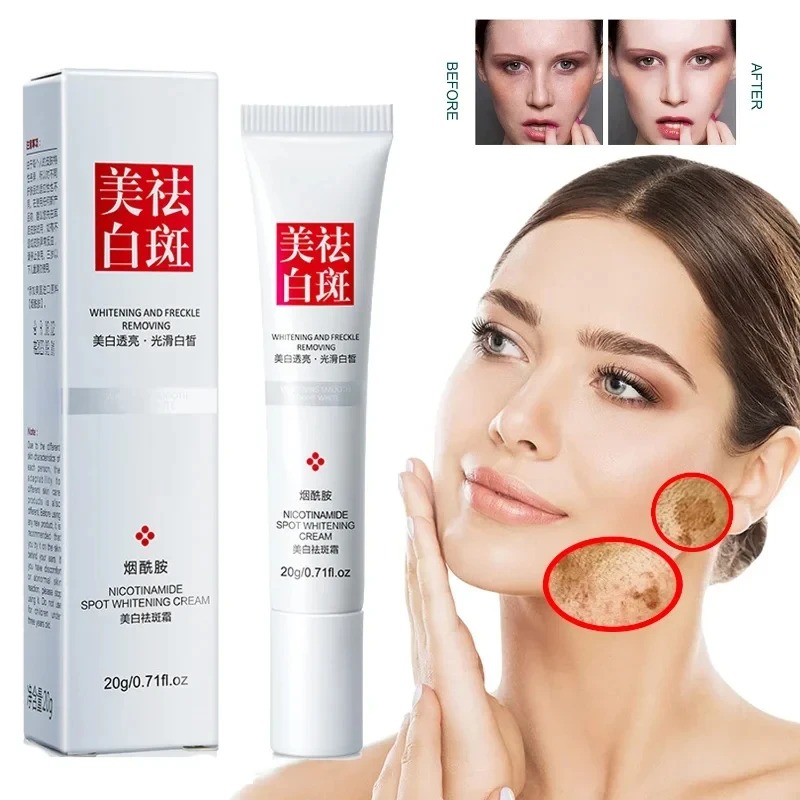 Crème blanchissante pour le vi - Healing Wellness avis et prix